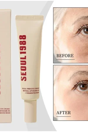 Seoul 1988 Retinol Eye Cream 4% Anti Aging Eye Treatment Dark Circles, Wrinkles, Puffiness Firming & Lifting Eye Cream For Women