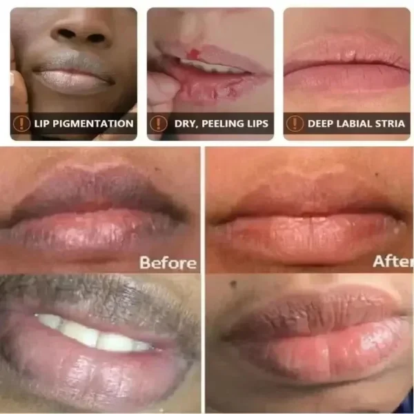 Fast Remove Dark Lip Balm Serum Lighten Melanin Lip Mask Exfoliating Fade Lip Lines Dead Skin Nourishing Repair Lip Care Makeup - Image 3